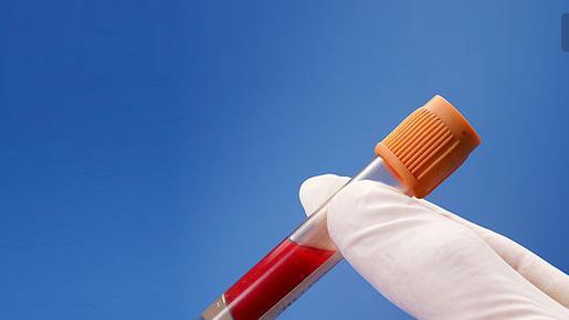 健康體檢一般檢查哪些項目？